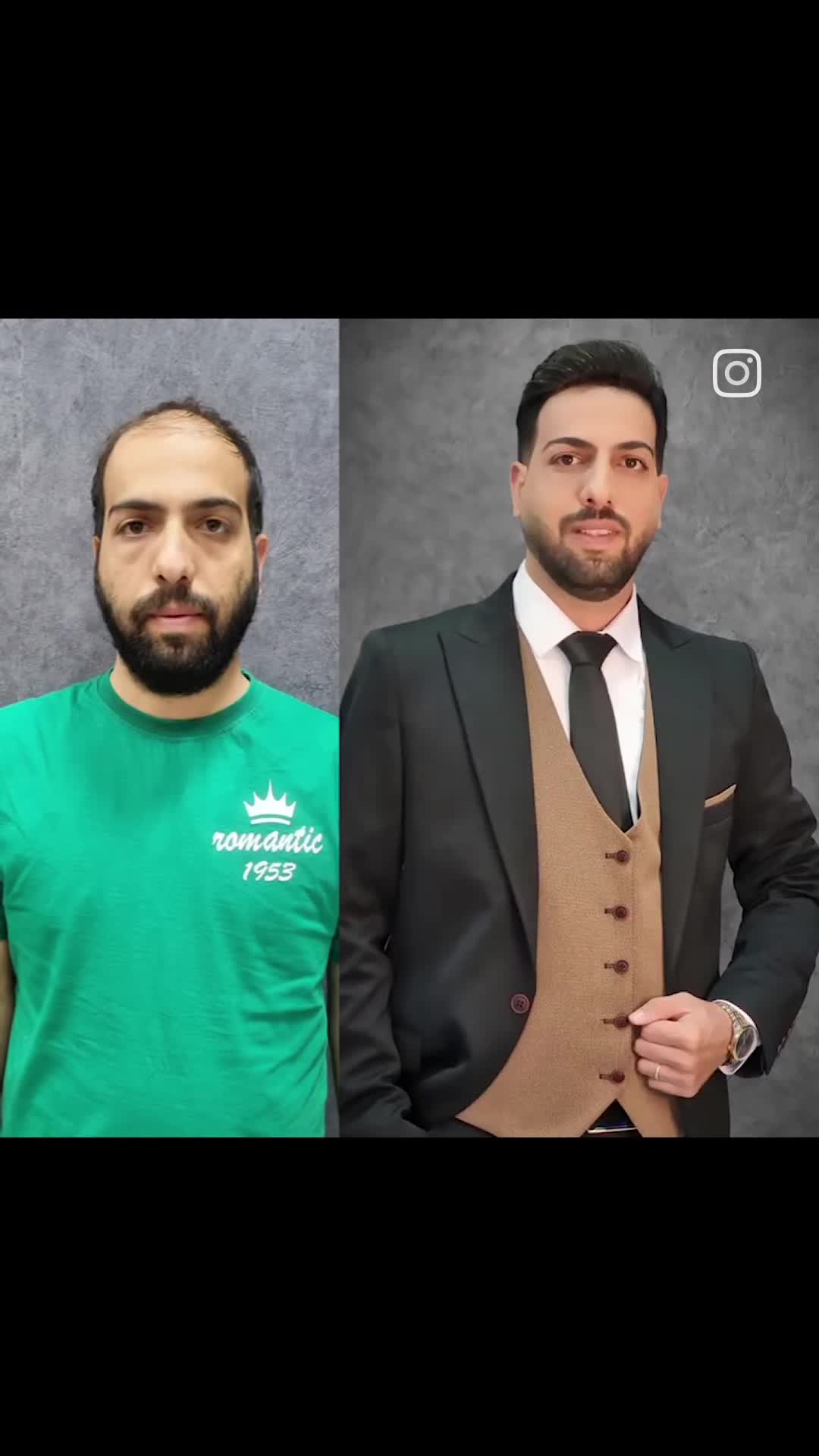 پیرایش میرداماد قم