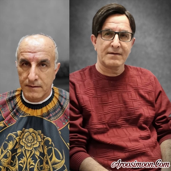 پیرایش میرداماد قم